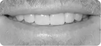 Dental treatment after procedure in Phoenix, AZ